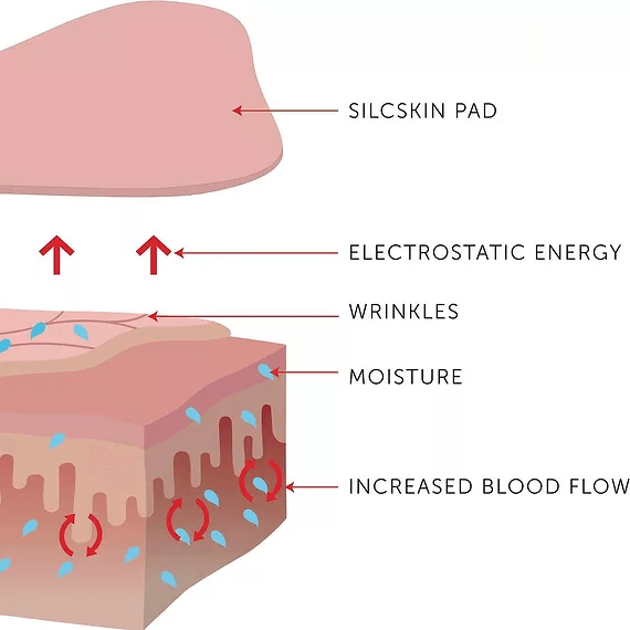 silcskin