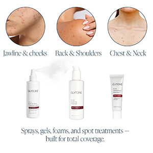 Acne Therapy