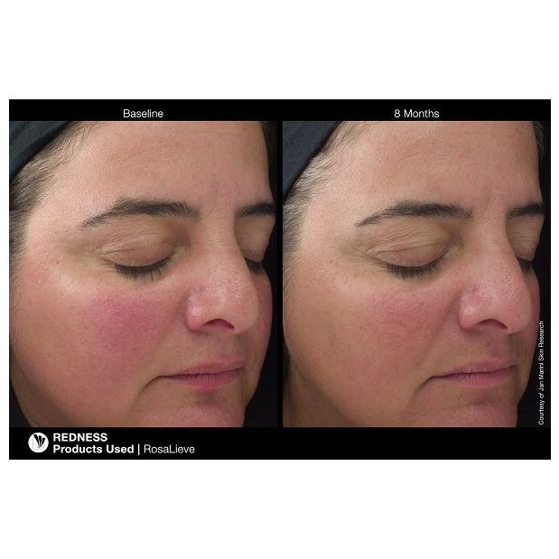 Jan Marini ROSALIEVE Redness Reducing Complex Face Lotion