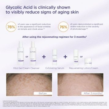 Glytone Mild Cream Cleanser  200ml