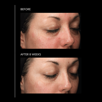 PCA Skin HydraMatte 