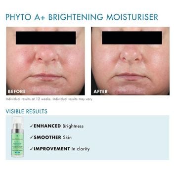 SkinCeuticals Phyto A+ Brightening Treatment