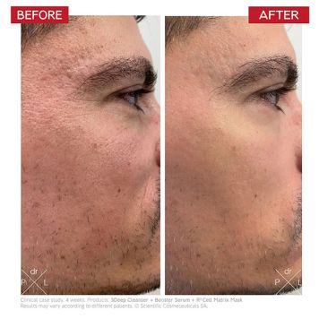 Dr LEVY Booster Serum