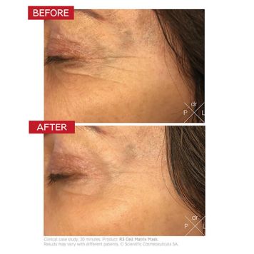 Dr LEVY R3 Cell Matrix Mask 