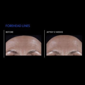 PCA Skin ExLinea Pro Peptide Serum  