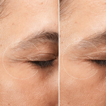 Medik8 Crystal Retinal Ceramide Eye 6