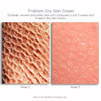 NeoStrata Resurface Problem Dry Skin Cream 