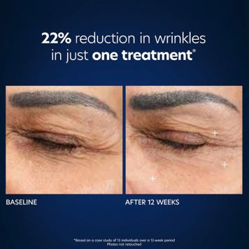 PCA Skin Hyaluronic Acid Microneedle Eye Patches