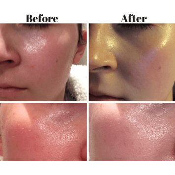 SkinCeuticals Redness Neutralizer 
