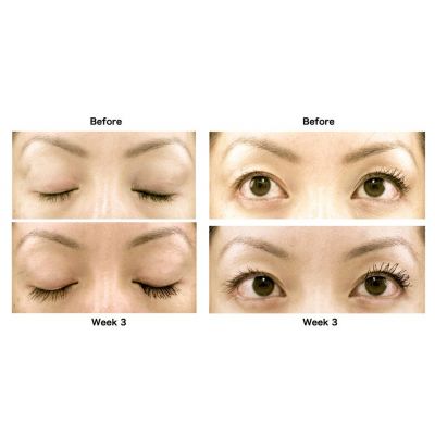 AQ Eyelash and Brow Enhancement System