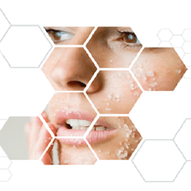 Microdermabrasion At Home Microdermabrasion At Home