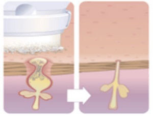 clarify diagram