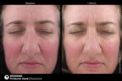 Jan Marini ROSALIEVE Redness Reducing Complex Face Lotion
