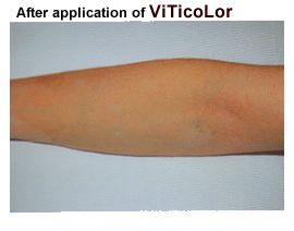 viticolor after