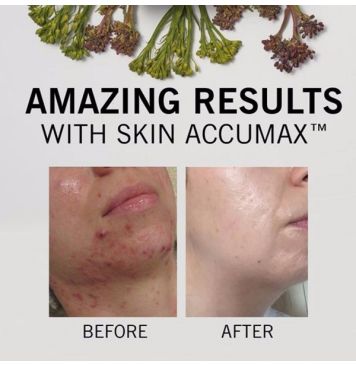 Advanced Nutrition Programme Skin Accumax