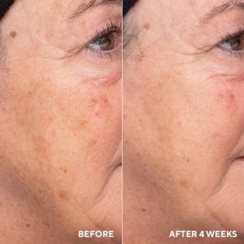 HydroPeptide Liquid Resurfacing Solution -  Expiry Date 30th November 2026 (non-refundable)