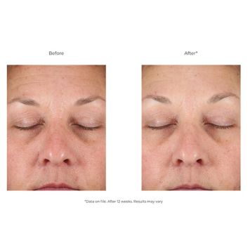 Revision Skincare D E J Face Cream 48g