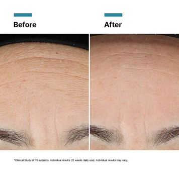 SkinCeuticals Advanced RGN-6 