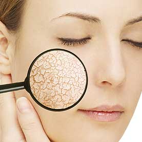 Tips and Advice to Help Treat Eczema and other dry skin conditions