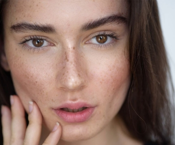From causes to cures, here’s what you need to know about tackling sun spots and melasma..