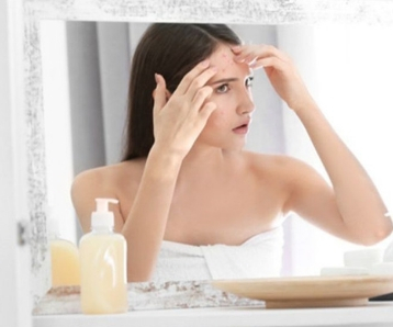 4 Essential Steps To Banish Those Blemishes