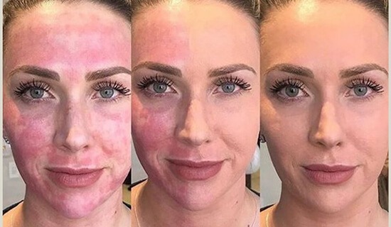 dermacare