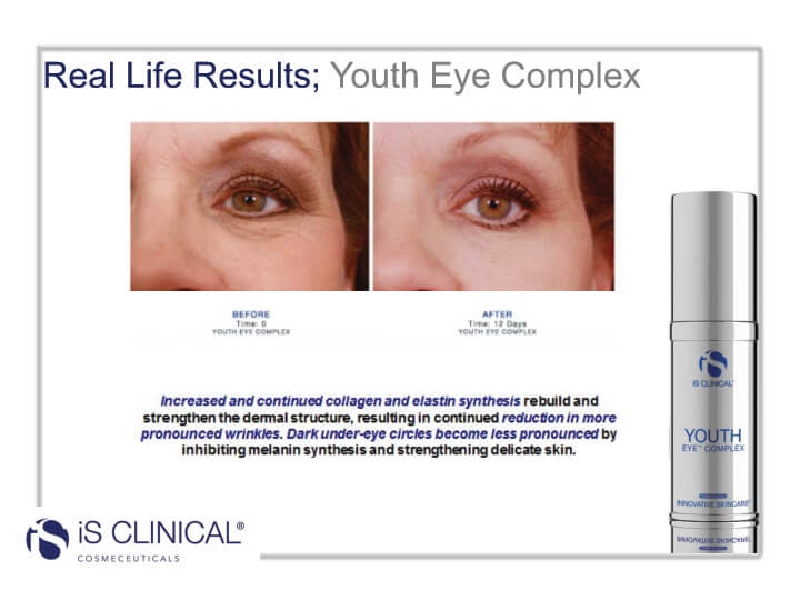 youth eye before and after image