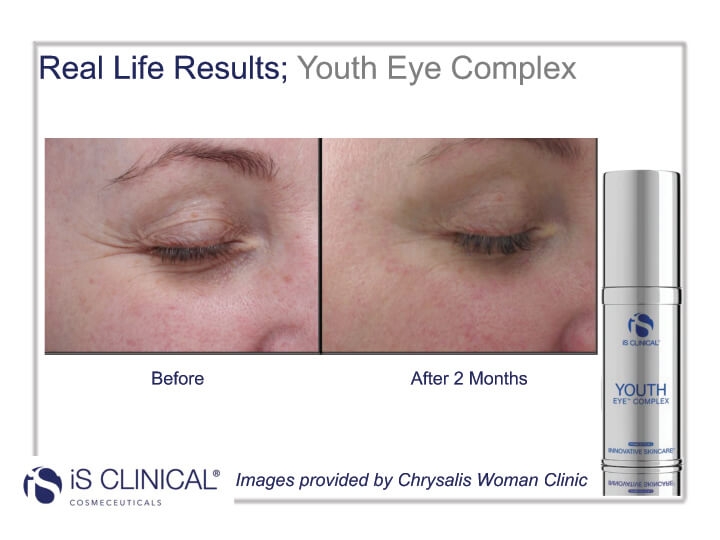 youth eye before and after image