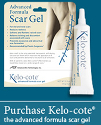 kelo-cote